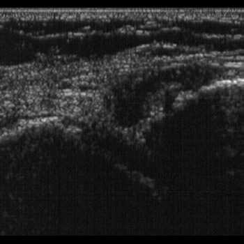 Ecografie - studiu de caz